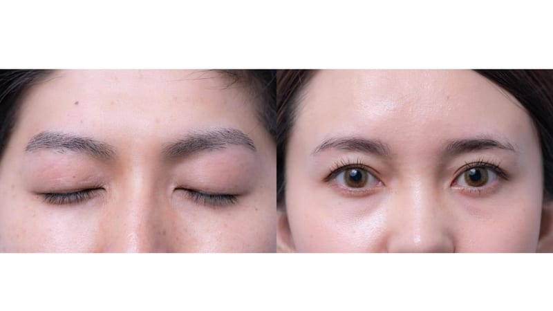 一度脱毛した眉毛はケア要らず次世代アイブロウ・眉毛脱毛研究所 MDラボ大垣店の店内写真2