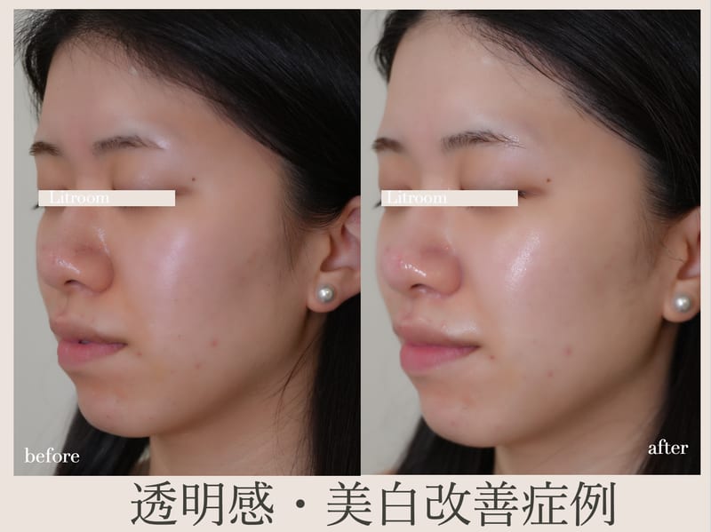Litroom: from Seoul（宮崎）のメンズ眉毛サロン